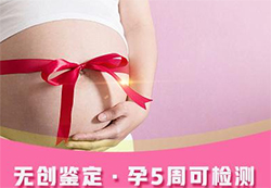 在山西刚怀孕如何做胎儿亲子鉴定，山西办理孕期亲子鉴定准确性高吗